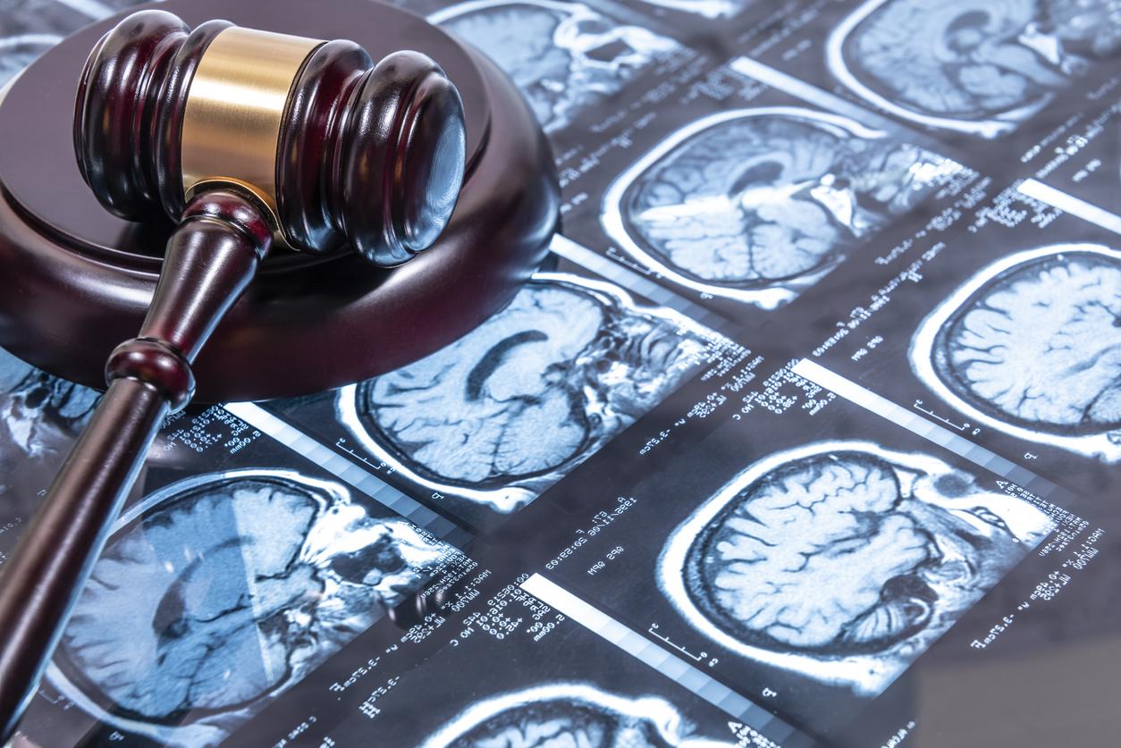 Judge's Studying a Disability Case with help of a Brain MRI in Buffalo, NY